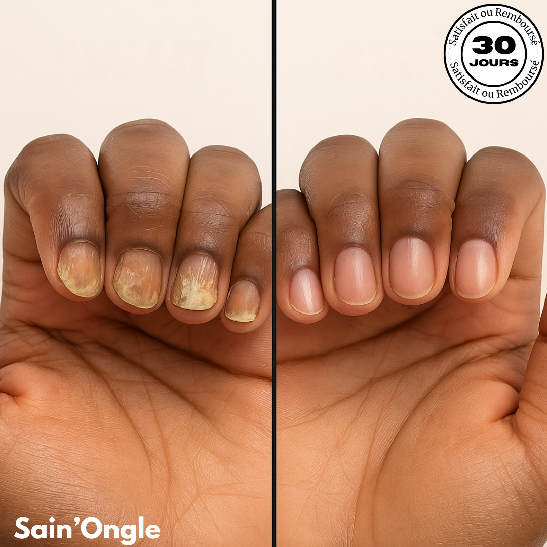 𝐒𝐚𝐢𝐧’𝐎𝐧𝐠𝐥𝐞 𝐂𝐚𝐫𝐞+ 𝐂𝐚𝐦𝐞𝐫𝐨𝐮𝐧